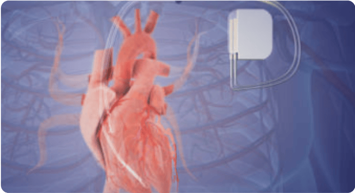 Dr. Sultan M Siddique, MD - Heart Rhythm Specialist | Cardiac ...