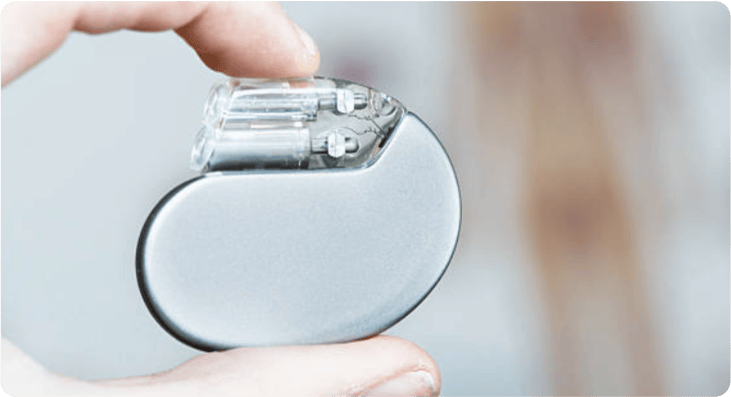 Traditional Pacemaker Definition Dr. Sultan M Siddique, MD - Heart Rhythm Specialist | Cardiac ...